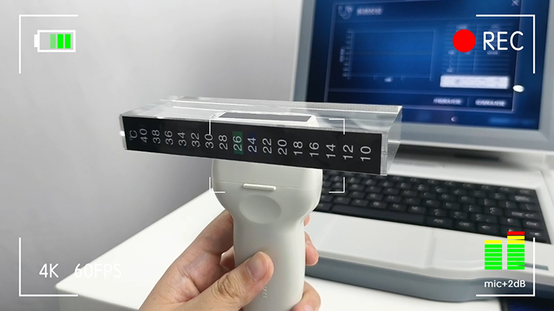 如何正確維護(hù)超聲骨密度儀？骨密度儀廠家建議的養(yǎng)護(hù)規(guī)范